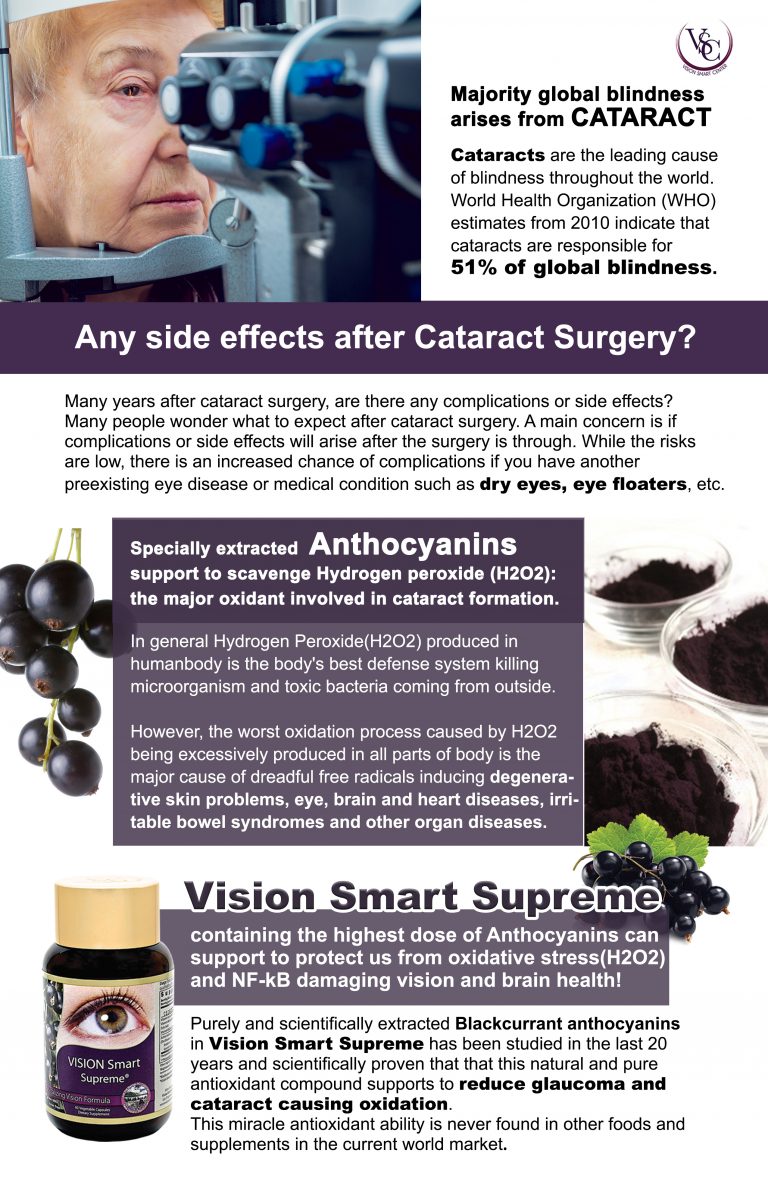 any-side-effects-after-cataract-surgery-vision-smartvision-smart